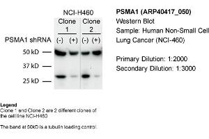Sample Type: Human non-small cell lung cancer (NCI-460)Primary Dilution: 1:2000Secondary Dilution: 1:300050kDa band is a tubulin loading control band (PSMA1 antibody  (C-Term))