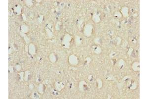 Immunohistochemistry of paraffin-embedded human brain tissue using ABIN7167001 at dilution of 1:100 (RABGEF1 antibody  (AA 1-491))