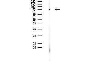 Western blot analysis of lysates from HepG2 cells(heat-shock,45 min treatment), using YAP Antibody at 1/1000 dilution.