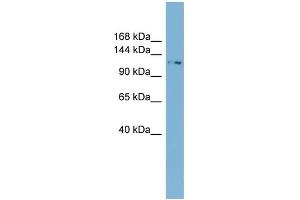 WB Suggested Anti-TTC17 Antibody Titration: 0. (TTC17 antibody  (N-Term))