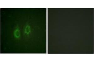 Immunofluorescence analysis of HeLa cells, using Connexin 43 (Ab-261) Antibody. (Connexin 43/GJA1 antibody  (AA 226-275))