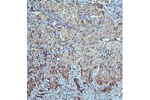 IHC analysis of ALDH1A1 using anti-ALDH1A1 antibody (ABIN7602127).