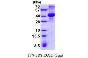 Figure annotation denotes ug of protein loaded and % gel used. (AMN Protein)