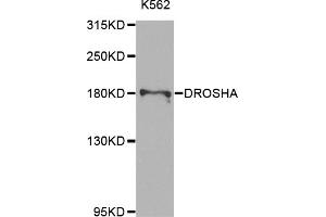 Western blot analysis of extracts of K-562 cells, using DROSHA antibody. (DROSHA antibody)