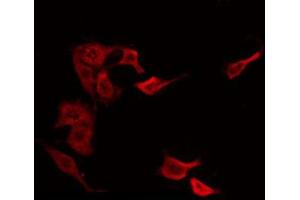 ABIN6266557 staining NIH-3T3 by IF/ICC. (HCG beta antibody)