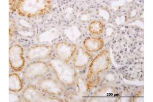Image no. 1 for anti-ACC Synthase-Like Protein 1 (ACCS) (AA 1-101) antibody (ABIN466256) (PHACS antibody  (AA 1-101))