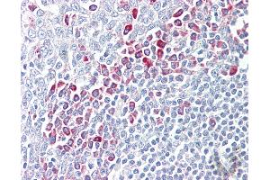 Anti-PARP6 antibody IHC of human tonsil. (PARP6 antibody  (AA 431-480))