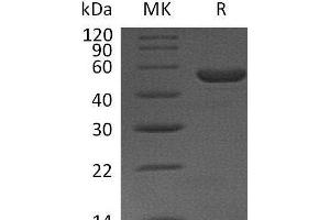 Western Blotting (WB) image for Interleukin 11 (IL11) protein (Fc Tag) (ABIN7320821) (IL-11 Protein (Fc Tag))