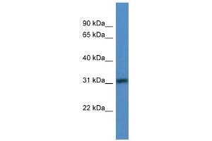 WB Suggested Anti-TBRG1 Antibody Titration: 0. (TBRG1 antibody  (N-Term))