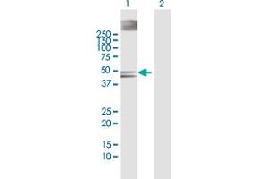 Western Blot analysis of RP6-213H19. (STK26/MST4 antibody  (AA 1-416))