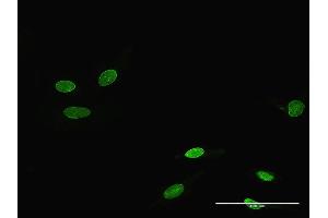 Immunofluorescence of purified MaxPab antibody to RORA on HeLa cell. (RORA antibody  (AA 1-468))