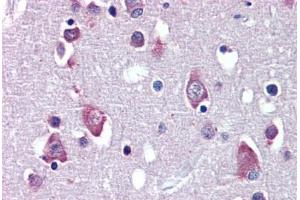 Brain, cortex, Human: Formalin-Fixed, Paraffin-Embedded (FFPE) (BDNF antibody  (AA 183-194))