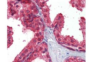 Anti-CLIP1 / CLIP170 antibody IHC of human prostate. (CLIP1 antibody  (AA 1404-1417))