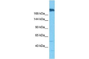 Host:  Rabbit  Target Name:  SNRNP200  Sample Tissue:  Human A549 Whole Cell  Antibody Dilution:  1ug/ml (SNRNP200 antibody  (N-Term))