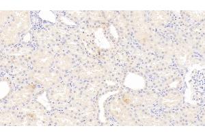 Detection of IL12B in Human Kidney Tissue using Monoclonal Antibody to Interleukin 12B (IL12B) (IL12B antibody  (AA 30-320))