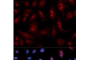 Immunofluorescence analysis of U2OS cells using PLCB1 Polyclonal Antibody (Phospholipase C beta 1 antibody)
