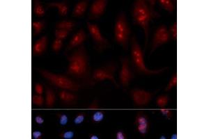 Immunofluorescence analysis of U2OS cells using PLCB1 Polyclonal Antibody (Phospholipase C beta 1 antibody)