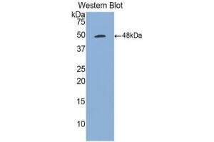 Western blot analysis of the recombinant protein. (CD70 antibody  (AA 47-191))
