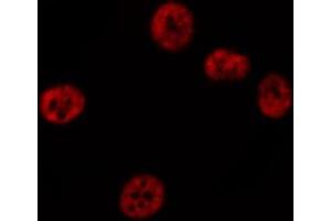 ABIN6267503 staining A-431 cells by IF/ICC.