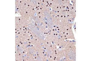 Immunohistochemistry of paraffin-embedded mouse brain using CTIP2/BCL11B Rabbit mAb (ABIN7265807) at dilution of 1:100 (40x lens). (BCL11B antibody)