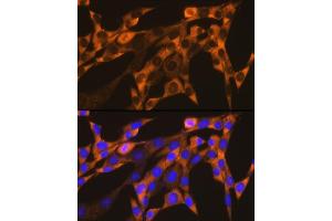 Immunofluorescence (IF) image for anti-Y Box Binding Protein 1 (YBX1) antibody (ABIN7271410)