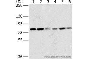 Western blot analysis of 293T and hela cell, human testis tissue, skov3, Raji and Jurkat cell, using NOX5 Polyclonal Antibody at dilution of 1:200 (NOX5 antibody)