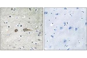 Immunohistochemistry analysis of paraffin-embedded human brain tissue, using MADD Antibody. (MADD antibody  (AA 751-800))