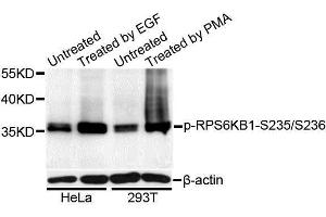 Western blot analysis of extracts of HeLa and 293T cells, using Phospho-RPS6KB1-S235/236 antibody (ABIN5995796) at 1/1000 dilution. (RPS6 antibody  (pSer235, pSer236))