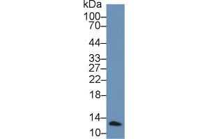 Rabbit Capture antibody from the kit in WB with Positive Control: Human leukocyte lysate.