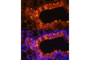 Immunofluorescence analysis of mouse bronchus using Cytokeratin 7 (Cytokeratin 7 (KRT7)) antibody (ABIN6129292, ABIN6143037, ABIN6143039 and ABIN6215559) at dilution of 1:100.