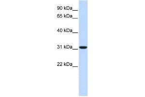 Carbonic Anhydrase VIII antibody used at 1 ug/ml to detect target protein. (CA8 antibody  (Middle Region))