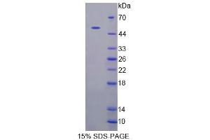 SDS-PAGE (SDS) image for Ca++-Dependent Secretion Activator (CADPS) (AA 1186-1352) protein (His tag,GST tag) (ABIN6239160)