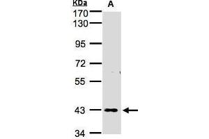 WB Image Sample(30 ug whole cell lysate) A:H1299 7. (ZNF211 antibody)