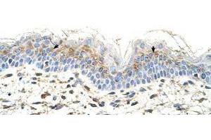 Image no. 1 for anti-S100 Calcium Binding Protein A3 (S100A3) (N-Term) antibody (ABIN204985) (S100A3 antibody  (N-Term))