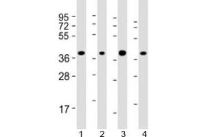 Western blot testing of human 1) HepG2, 2) Jurkat, 3) Li-7 and 4) RPMI-8226 cell lysate with ARHGEF39 antibody at 1:2000. (C9orf100 antibody  (AA 180-211))
