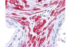 Stat5b antibody was used for immunohistochemistry at a concentration of 4-8 ug/ml. (STAT5B antibody  (C-Term))