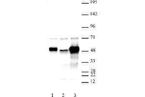 C17orf96 antibody (pAb) tested by Western blot. (C17ORF96 antibody  (AA 59-229))