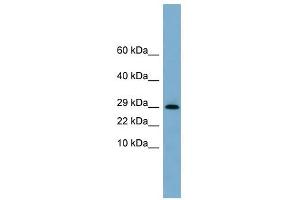 ERP29 antibody used at 1 ug/ml to detect target protein.