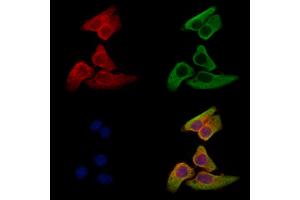 anti-Sulfatase 2 (SULF2) (Internal Region) antibody