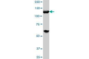 HDAC4 monoclonal antibody (M03), clone 2B11. (HDAC4 antibody  (AA 551-648))