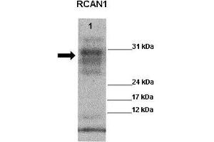 WB Suggested Anti-RCAN1 Antibody    Positive Control:  Lane 1: 20ug Wild type mouse, left ventricle   Primary Antibody Dilution :   1:1000  Secondary Antibody :  Goat anti rabbit-HRP   Secondry Antibody Dilution :   1:5,000  Submitted by:  Kathleen Gabrielson