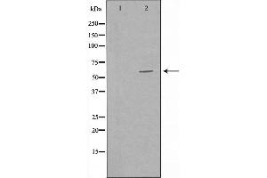 Western blot analysis of extracts from Jurkat cells, using ALS2CR13 antibody. (FAM117B antibody  (Internal Region))