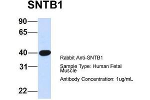Host:  Rabbit  Target Name:  SNTB1  Sample Type:  Human Fetal Muscle  Antibody Dilution:  1.