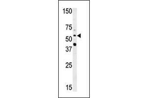 Western blot analysis of anti-NMT2 Pab (ABIN389095 and ABIN2839287) in HepG2 cell line lysate (35 μg/lane). (NMT2 antibody  (N-Term))