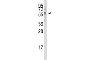 Western blot analysis of Tip60 antibody in Jurkat lysate (KAT5 antibody  (AA 33-64))
