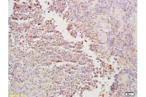 Immunohistochemistry (IHC) image for anti-Anterior Pharynx Defective 1 Homolog A (C. Elegans) (APH1A) (AA 71-170) antibody (ABIN706016)