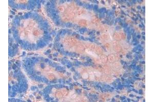 Immunohistochemistry (IHC) image for anti-Janus Kinase 2 (JAK2) (AA 916-1103) antibody (ABIN7438352)