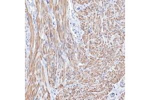 Immunohistochemical staining of human smooth muscle with TPM1 polyclonal antibody  shows moderate cytoplasmic positivity in smooth muscle cells. (Tropomyosin antibody  (AA 128-243))