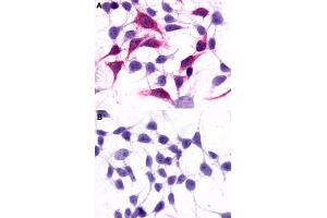 Immunocytochemistry (ICC) staining of HEK293 human embryonic kidney cells transfected (A) or untransfected (B) with GRM3. (Metabotropic Glutamate Receptor 3 antibody  (Extracellular Domain))