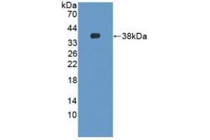 Detection of Recombinant DEFb2, Mouse using Polyclonal Antibody to Defensin Beta 2 (DEFb2) (beta 2 Defensin antibody  (AA 21-71))